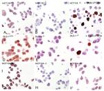 PTEN Antibody in Immunohistochemistry (IHC)