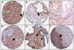 PTEN Antibody in Immunohistochemistry (IHC)