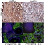 PTEN Antibody in Immunohistochemistry (IHC)