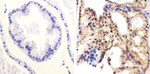 PTEN Antibody in Immunohistochemistry (Paraffin) (IHC (P))