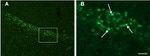 beta Amyloid Antibody in Immunohistochemistry (IHC)