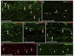 beta Amyloid Antibody in Immunohistochemistry (IHC)