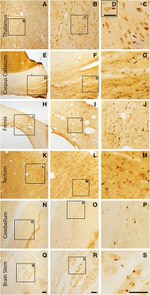 beta Amyloid Antibody in Immunohistochemistry (IHC)