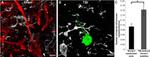 beta Amyloid Antibody in Immunohistochemistry (IHC)