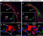 Connexin 26 Antibody in Immunohistochemistry (IHC)