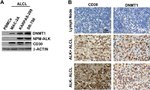 ALK Antibody in Western Blot (WB)