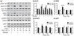 ALK Antibody in Western Blot (WB)