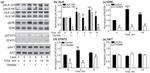 ALK Antibody in Western Blot (WB)