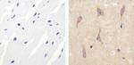 ALK Antibody in Immunohistochemistry (Paraffin) (IHC (P))