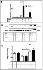 HDAC2 Antibody in Western Blot (WB)