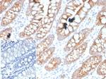 PDGF beta (PDGFB) Antibody in Immunohistochemistry (Paraffin) (IHC (P))