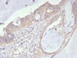 PDGFR-A (Platelet Derived Growth Factor Receptor, alpha)/CD140a Antibody in Immunohistochemistry (Paraffin) (IHC (P))