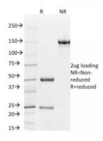 CD31/PECAM-1 (Endothelial Cell Marker) Antibody in SDS-PAGE (SDS-PAGE)