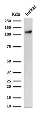 CD31/PECAM-1 (Endothelial Cell Marker) Antibody in Western Blot (WB)