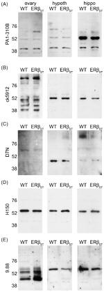 Estrogen Receptor beta Antibody in Western Blot (WB)