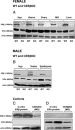 Estrogen Receptor beta Antibody in Western Blot (WB)