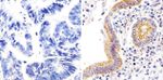 Claudin 1 Antibody in Immunohistochemistry (Paraffin) (IHC (P))