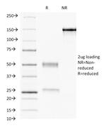 Progesterone Receptor (Marker of Progestin Dependence) Antibody in SDS-PAGE (SDS-PAGE)