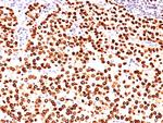 Progesterone Receptor (Marker of Progestin Dependence) Antibody in Immunohistochemistry (Paraffin) (IHC (P))