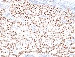 Progesterone Receptor (Marker of Progestin Dependence) Antibody in Immunohistochemistry (Paraffin) (IHC (P))