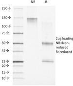 Progesterone Receptor (Marker of Progestin Dependence) Antibody in SDS-PAGE (SDS-PAGE)