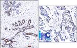 Progesterone Receptor (Marker of Progestin Dependence) Antibody in Immunohistochemistry (Paraffin) (IHC (P))