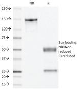 Progesterone Receptor (Marker of Progestin Dependence) Antibody in SDS-PAGE (SDS-PAGE)