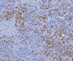 Progesterone Receptor (Marker of Progestin Dependence) Antibody in Immunohistochemistry (Paraffin) (IHC (P))