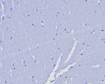 Progesterone Receptor (Marker of Progestin Dependence) Antibody in Immunohistochemistry (Paraffin) (IHC (P))