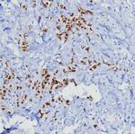 Progesterone Receptor (Marker of Progestin Dependence) Antibody in Immunohistochemistry (Paraffin) (IHC (P))