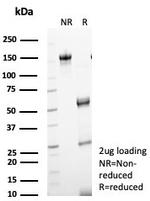 Progesterone Receptor (Marker of Progestin Dependence) Antibody in SDS-PAGE (SDS-PAGE)