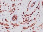 Progesterone Receptor (Marker of Progestin Dependence) Antibody in Immunohistochemistry (Paraffin) (IHC (P))