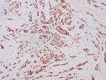 Progesterone Receptor (Marker of Progestin Dependence) Antibody in Immunohistochemistry (Paraffin) (IHC (P))