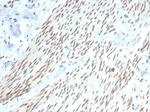 Progesterone Receptor (Marker of Progestin Dependence) Antibody in Immunohistochemistry (Paraffin) (IHC (P))