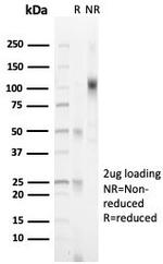 Progesterone Receptor (Marker of Progestin Dependence) Antibody in SDS-PAGE (SDS-PAGE)