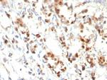 Progesterone Receptor (Marker of Progestin Dependence) Antibody in Immunohistochemistry (Paraffin) (IHC (P))