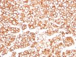 P-glycoprotein/p170/MDR1/CD243 Antibody in Immunohistochemistry (Paraffin) (IHC (P))