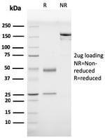 Prohibitin Antibody in SDS-PAGE (SDS-PAGE)