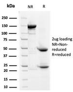 Prohibitin (Mitochondrial Marker) Antibody in SDS-PAGE (SDS-PAGE)