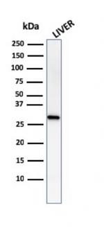 Prohibitin (Mitochondrial Marker) Antibody in Western Blot (WB)