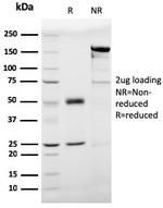 Prohibitin Antibody in SDS-PAGE (SDS-PAGE)