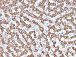 Prohibitin (Mitochondrial Marker) Antibody in Immunohistochemistry (Paraffin) (IHC (P))