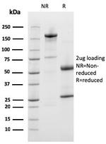 Prohibitin Antibody in SDS-PAGE (SDS-PAGE)