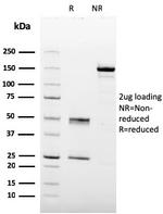 Prohibitin Antibody in SDS-PAGE (SDS-PAGE)