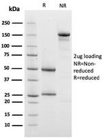 Prohibitin (Mitochondrial Marker) Antibody in SDS-PAGE (SDS-PAGE)