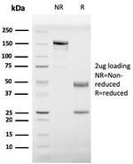 Prohibitin (Mitochondrial Marker) Antibody in SDS-PAGE (SDS-PAGE)