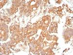 Alpha-1-Antitrypsin (SERPINA1) (Hepatocellular and Histiocytic Marker) Antibody in Immunohistochemistry (Paraffin) (IHC (P))