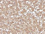 Alpha-1-Antitrypsin (SERPINA1) (Hepatocellular and Histiocytic Marker) Antibody in Immunohistochemistry (Paraffin) (IHC (P))