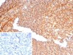 Alpha-1-Antitrypsin (SERPINA1) (Hepatocellular and Histiocytic Marker) Antibody in Immunohistochemistry (Paraffin) (IHC (P))