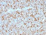 Alpha-1-Antitrypsin (SERPINA1) Antibody in Immunohistochemistry (Paraffin) (IHC (P))